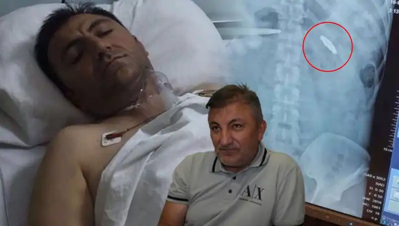 15 Temmuz'un Acı Mirası: Kurşunla Yaralanan Bir Hayat Hikayesi