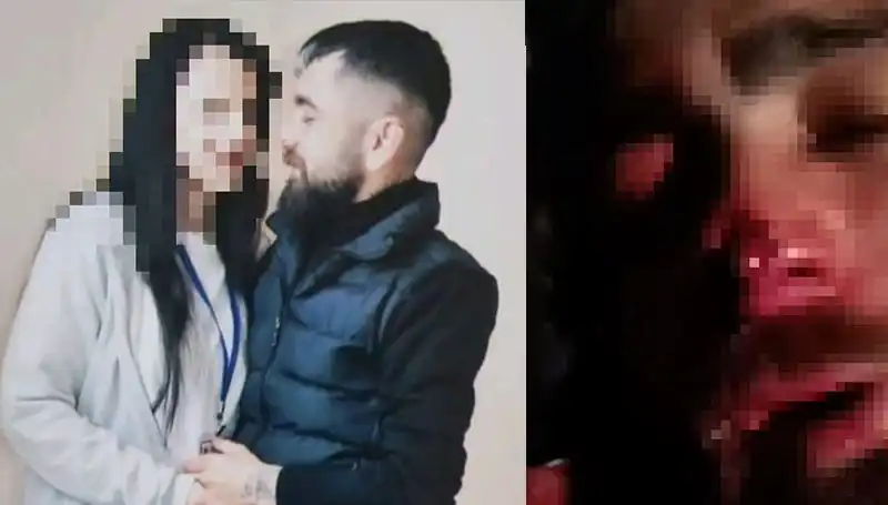 Eski Sevgilinin Abisinden Dehşet Veren İntikam: Kulağı ve Burnunu Kopardı